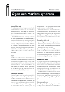 Ögon och Marfans syndrom - Svenska Marfanföreningen