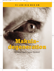 degeneration Makula