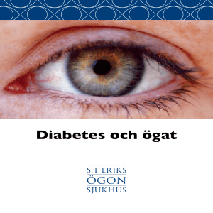 Diabetes och ögat - S:t Eriks Ögonsjukhus