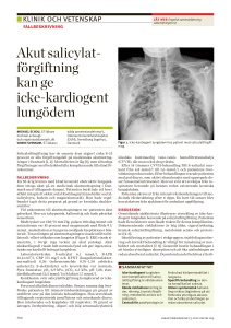 Akut salicylat- förgiftning kan ge icke-kardiogent