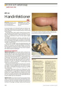Handinfektioner - Läkartidningen