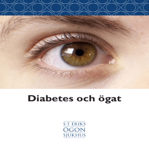 Diabetes och ögat - S:t Eriks Ögonsjukhus
