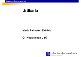 icke sederande antihistamin