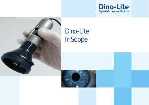 Dino-Lite IriScope - Dino