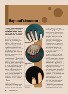 44 Raynauds fenomen