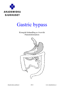 Gastric bypass - Akademiska sjukhuset