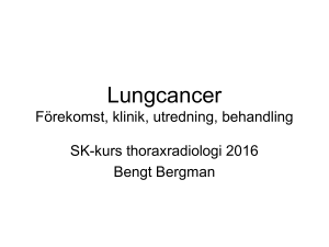 Lungcancer – framsteg och förhoppningar