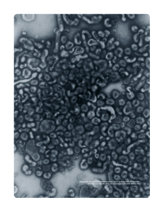 Elektronmikroskopisk bild på hästinfluensavirus. Viruset på bilden är