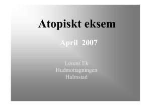 Atopiskt eksem - Region Halland