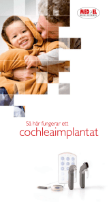 cochleaimplantat