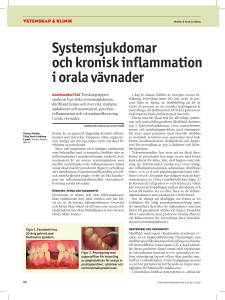 Systemsjukdomar och kronisk inflammation i orala vävnader