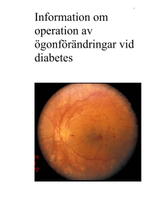 Operation av ögonförändringar vid diabetes