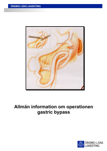 Allmän information om operationen gastric bypass